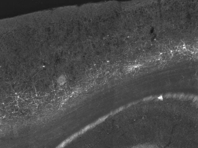 cortical cells. white cells on a gray background.