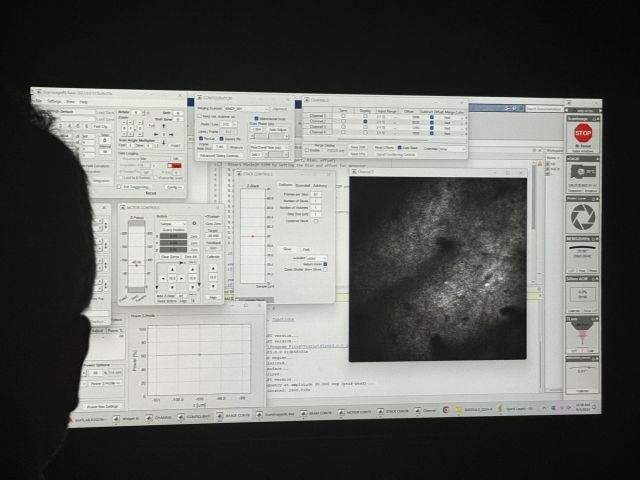 First mini2p recording