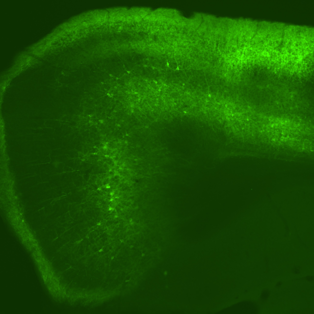 neural tissue expressing green fluorescent protein